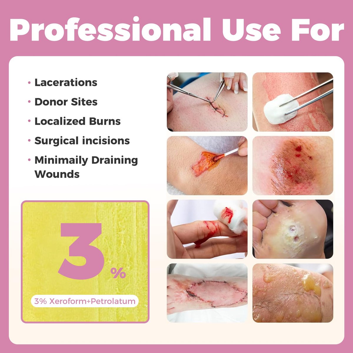 JUSORE Xeroform Petrolatum Verband 4"x4" - 25 einzeln verpackte, nicht haftende Gaze-Pads für Wundversorgung, Verbrennungen, Hauttransplantationen und chirurgische Einschnitte