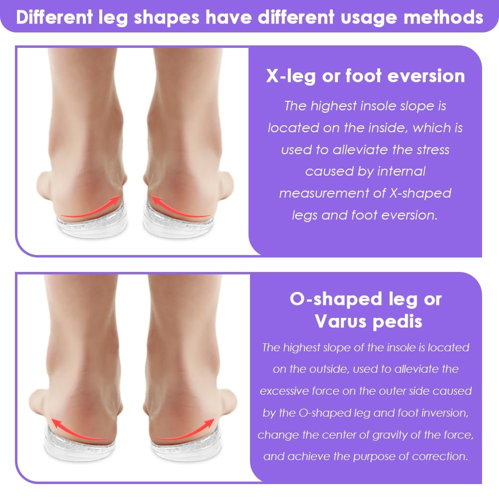 Svowin 3-lagige verstellbare Supination-Überpronation-Einlegesohlen, Anti-Rutsch mediale/laterale Fersenkeil-Einlegesohlen für Fußausrichtung, Knieschmerzen, O-Beine, Arthrose (Transparent, L: W 8-12/ M 7.5-14)