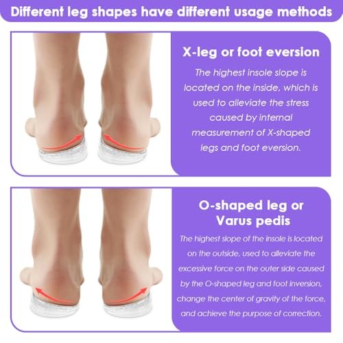 Svowin 3-lagige verstellbare Supination-Überpronation-Einlegesohlen, Anti-Rutsch mediale/laterale Fersenkeil-Einlegesohlen für Fußausrichtung, Knieschmerzen, O-Beine, Arthrose (Transparent, L: W 8-12/ M 7.5-14)