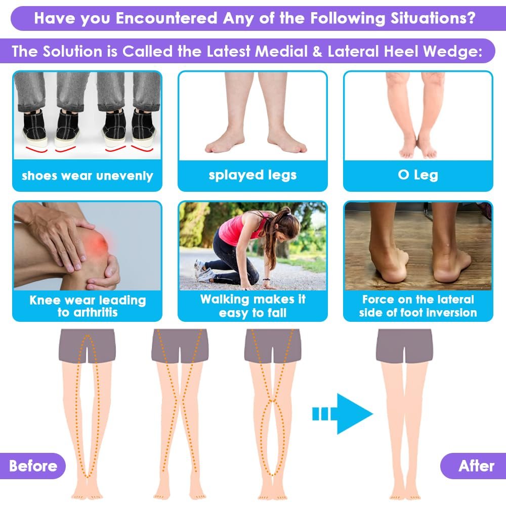Svowin 3-lagige verstellbare Supination-Überpronation-Einlegesohlen, Anti-Rutsch mediale/laterale Fersenkeil-Einlegesohlen für Fußausrichtung, Knieschmerzen, O-Beine, Arthrose (Transparent, L: W 8-12/ M 7.5-14)
