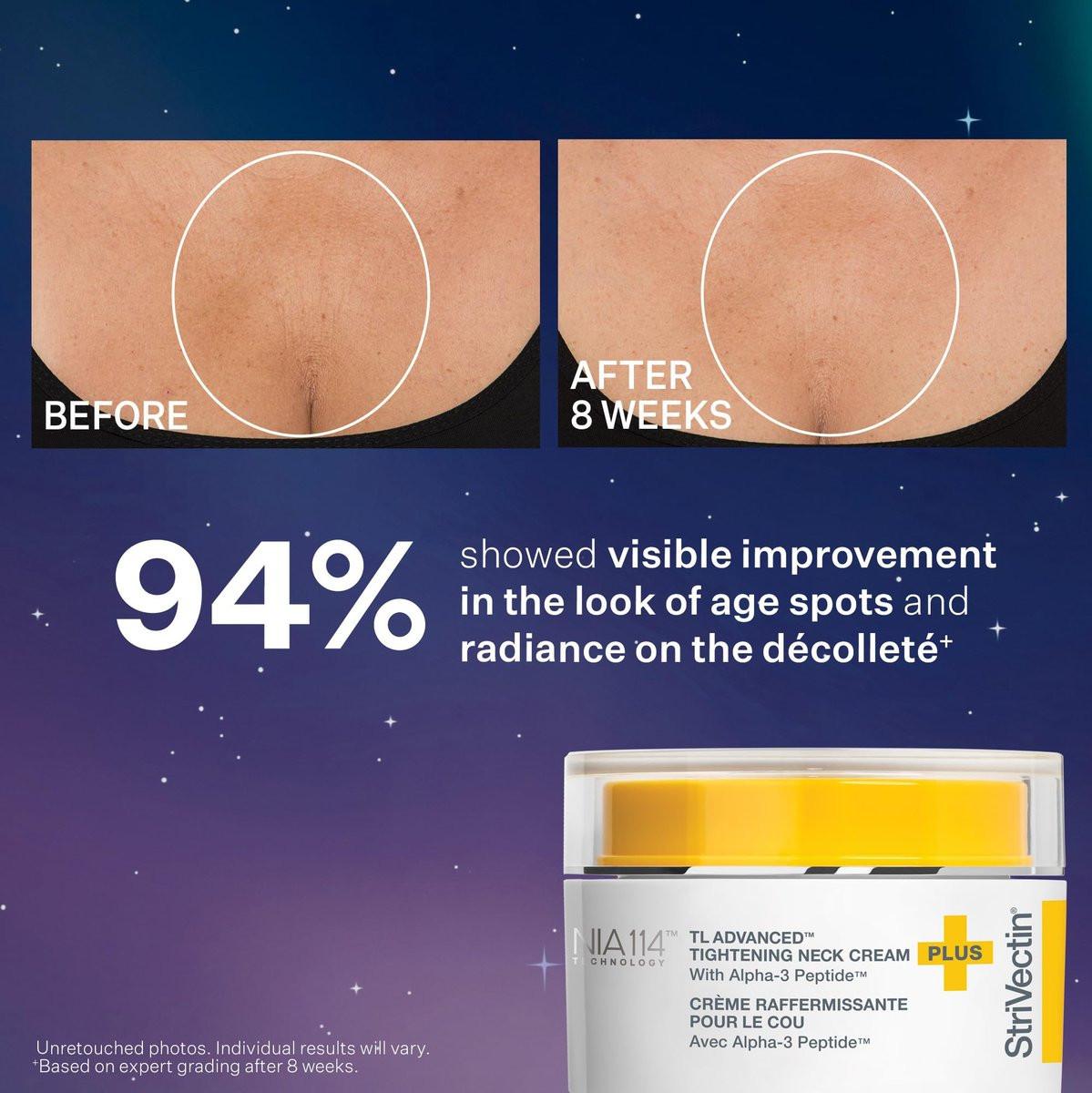 StriVectin TL Advanced Holiday Duo: Straffen und Formen Set – Haut straffen und aufhellen mit Peptiden und Hyaluronsäure