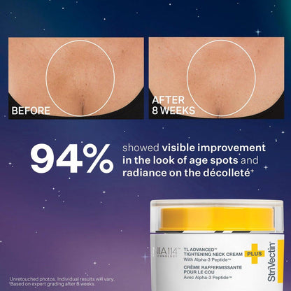 StriVectin TL Advanced Holiday Duo: Straffen und Formen Set – Haut straffen und aufhellen mit Peptiden und Hyaluronsäure