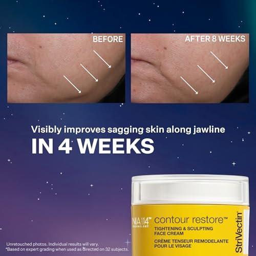 StriVectin TL Advanced Holiday Duo: Straffen und Formen Set – Haut straffen und aufhellen mit Peptiden und Hyaluronsäure
