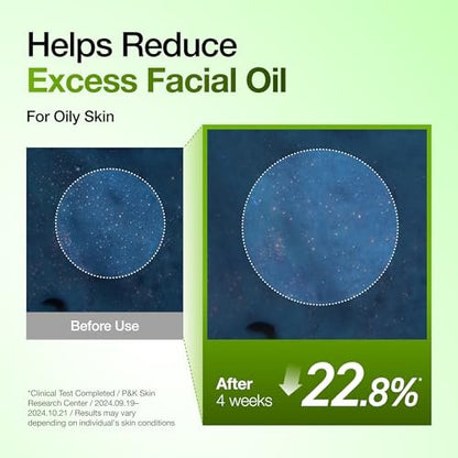 Anua Azelainsäure 10 Hyaluron Rötungsberuhigendes Serum – Gesichtsserum für zu Unreinheiten und Fett neigende Haut, Leicht & Feuchtigkeitsspendend, Hyaluronsäure, Koreanische Hautpflege, 30 ml