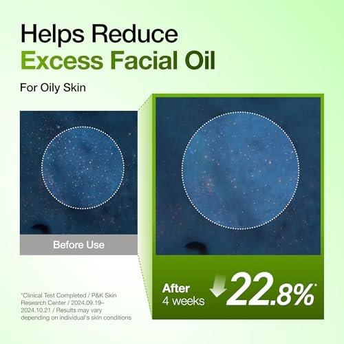 Anua Azelainsäure 10 Hyaluron Rötungsberuhigendes Serum – Gesichtsserum für zu Unreinheiten und Fett neigende Haut, Leicht & Feuchtigkeitsspendend, Hyaluronsäure, Koreanische Hautpflege, 30 ml