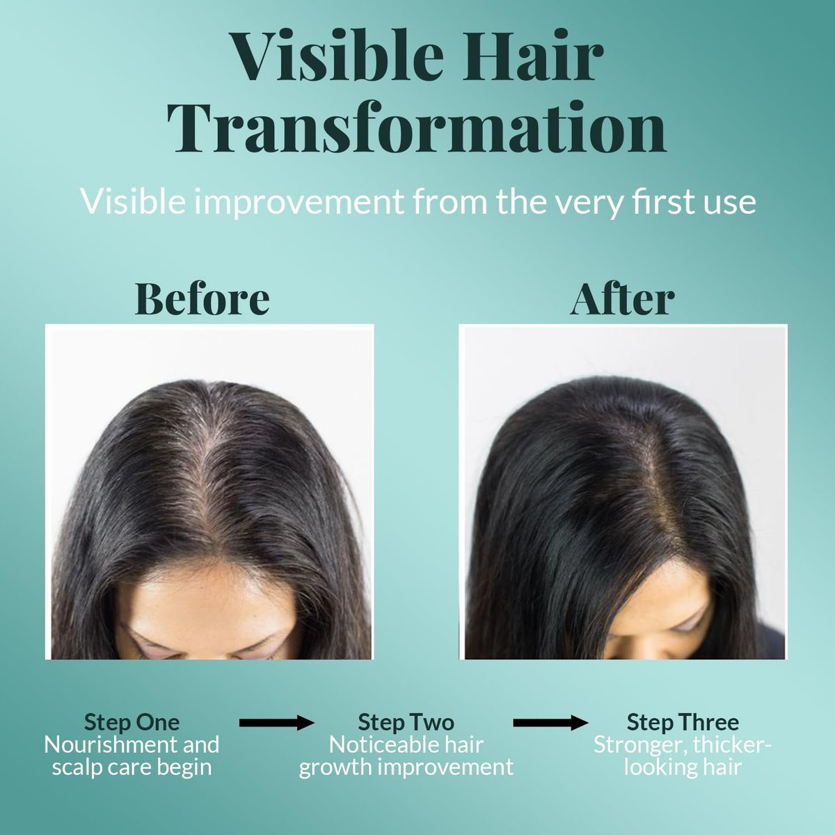 AVD ORGANICS Rosmarinöl für Haarwachstum & Kopfhaut | Angereichert mit Biotin | Haarstärkend, nährend & volumenverleihend | Mit Jojoba- & Rizinusöl | NON-GMO 120ml