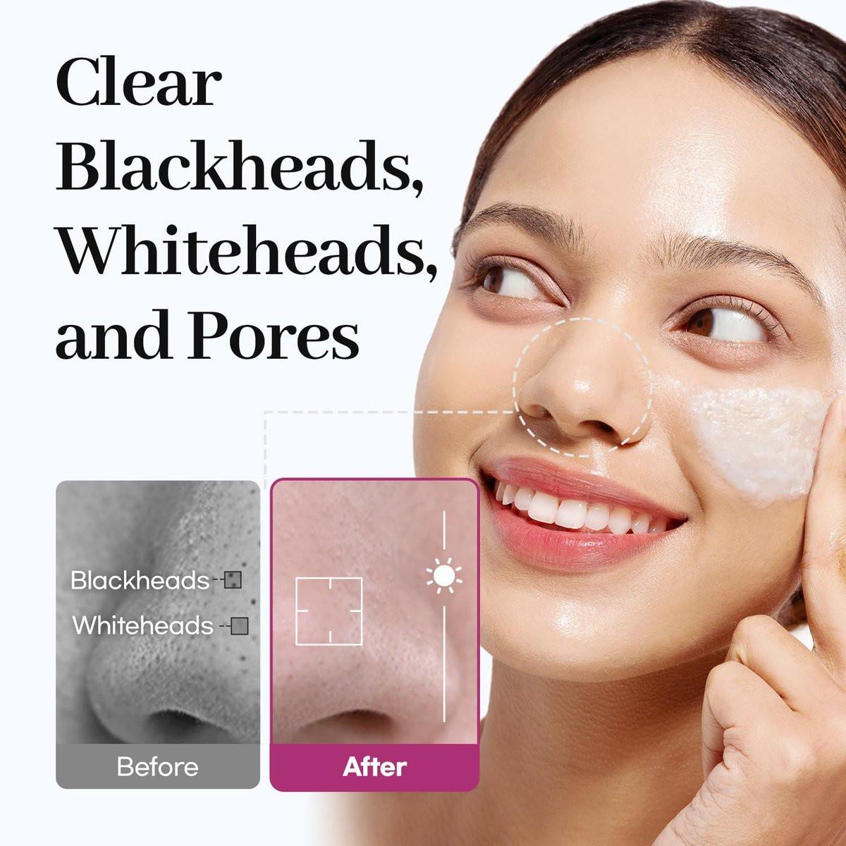 AROCELL Super Collagen Melting Balm 3,53 oz – Korean Make-up Entferner Balsam für Mitesser Pflege, Tiefenreinigung der Poren mit Peptiden, Feuchtigkeitsspendende Tägliche Gesichtsreinigung