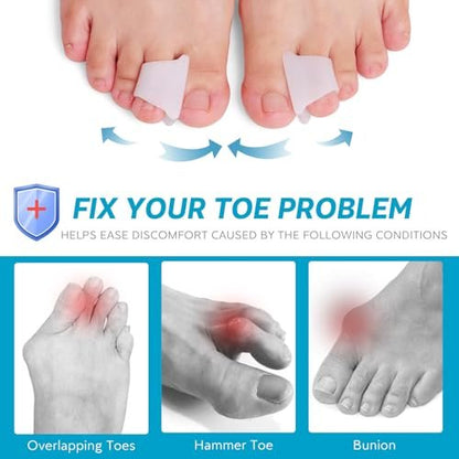 Nolimvita Hammer Toe Straightener Corrector – Zehenspacer für Ballenzehen, gekrümmte Zehen, Hammerzehen – Zehenkorrektor Zehenschiene für Männer und Frauen, 6er-Pack (Mittel)