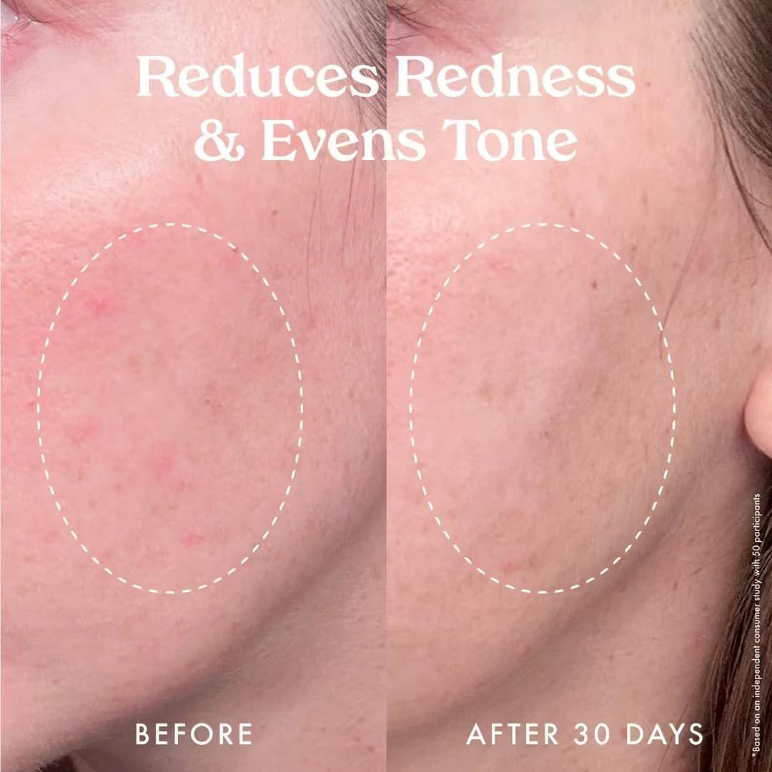 Kopari Star Bright Vitamin C Discoloration Correcting Serum mit Kakadu-Pflaume & Niacinamid – Für einen strahlenden, ebenmäßigen Teint, 50 ml