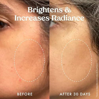 Kopari Star Bright Vitamin C Discoloration Correcting Serum mit Kakadu-Pflaume & Niacinamid – Für einen strahlenden, ebenmäßigen Teint, 50 ml