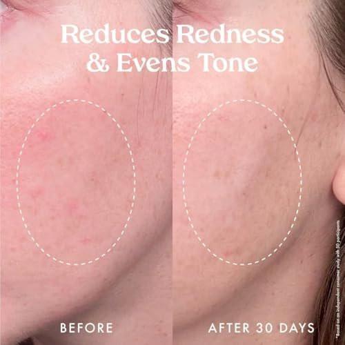 Kopari Star Bright Vitamin C Discoloration Correcting Serum mit Kakadu-Pflaume & Niacinamid – Für einen strahlenden, ebenmäßigen Teint, 50 ml