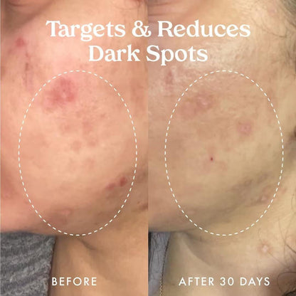 Kopari Star Bright Vitamin C Discoloration Correcting Serum mit Kakadu-Pflaume & Niacinamid – Für einen strahlenden, ebenmäßigen Teint, 50 ml