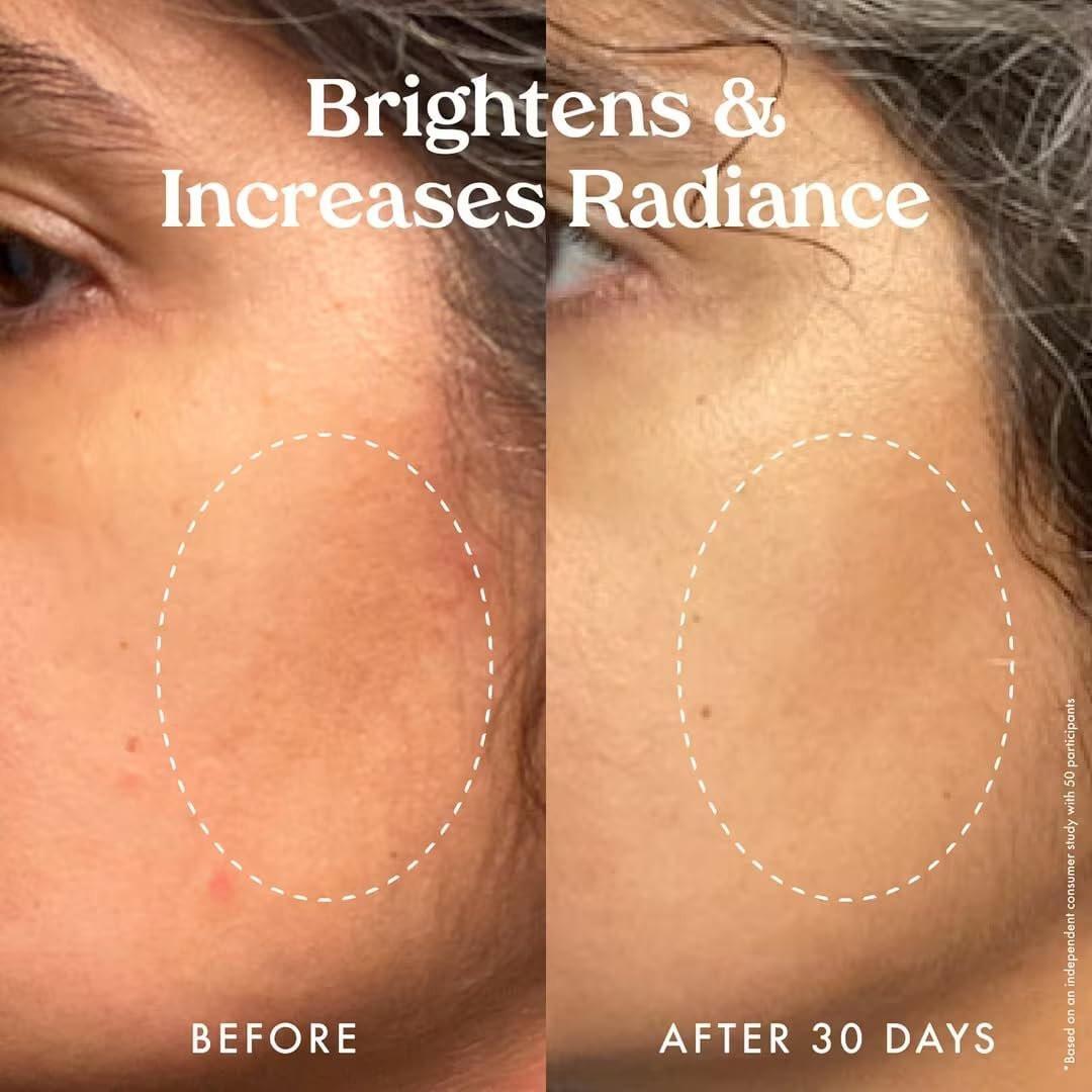 Kopari Star Bright Vitamin C Discoloration Correcting Serum mit Kakadu-Pflaume & Niacinamid – Für einen strahlenden, ebenmäßigen Teint, 50 ml