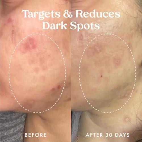 Kopari Star Bright Vitamin C Discoloration Correcting Serum mit Kakadu-Pflaume & Niacinamid – Für einen strahlenden, ebenmäßigen Teint, 50 ml