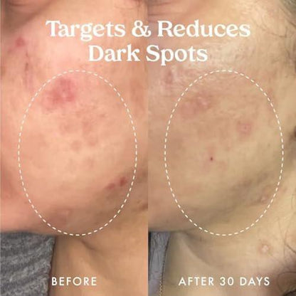 Kopari Star Bright Vitamin C Discoloration Correcting Serum mit Kakadu-Pflaume & Niacinamid – Für einen strahlenden, ebenmäßigen Teint, 50 ml