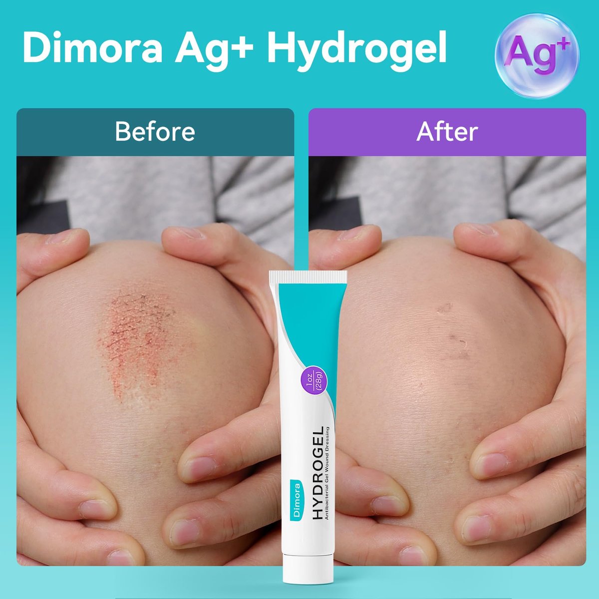 Dimora Antibakterielles Gel-Wundverband 1oz – Silber-Hydrogel Erste-Hilfe-Salbe zur Wundheilung, antibakterielle Pflege für kleine Schnitte, Schürfwunden, Platzwunden & Verbrennungen, sichere nicht-amorphe Formel