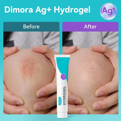Dimora Antibakterielles Gel-Wundverband 1oz – Silber-Hydrogel Erste-Hilfe-Salbe zur Wundheilung, antibakterielle Pflege für kleine Schnitte, Schürfwunden, Platzwunden & Verbrennungen, sichere nicht-amorphe Formel