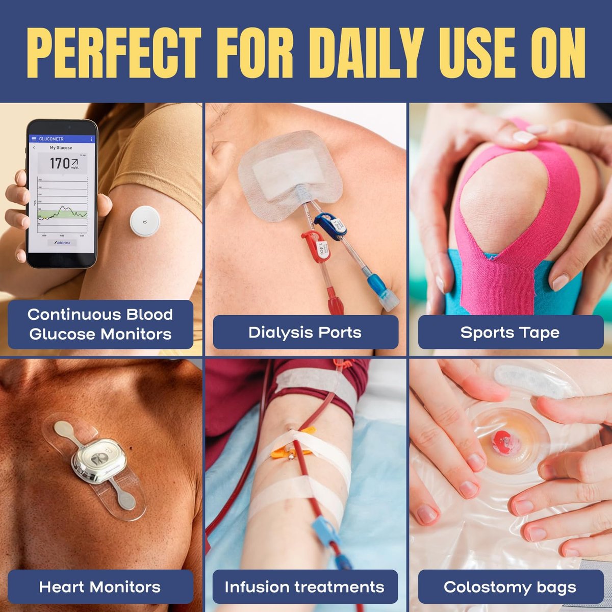 Sting-Free Adhesive Remover - 4 oz Sanfter & Schmerzfreier Pflasterentferner für empfindliche Haut, Sporttape, Dialysezugänge, kontinuierliche Blutzuckermessung und Stomaversorgung