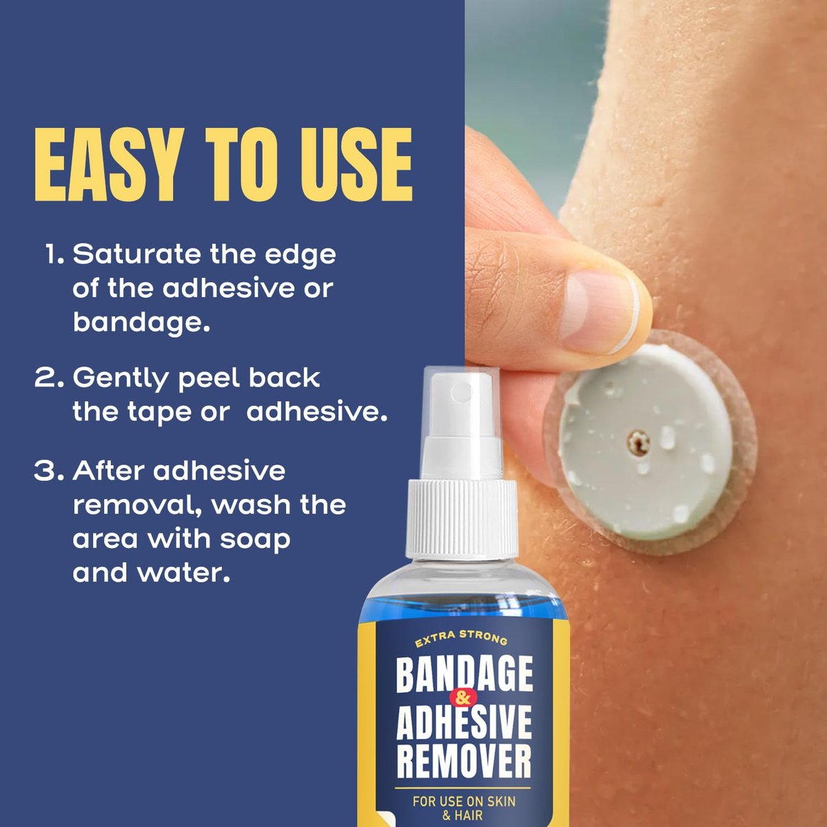 Sting-Free Adhesive Remover - 4 oz Sanfter & Schmerzfreier Pflasterentferner für empfindliche Haut, Sporttape, Dialysezugänge, kontinuierliche Blutzuckermessung und Stomaversorgung