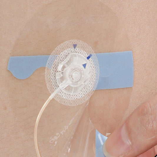 60 Stück Universal-Klebepflaster für CGM und Insulinpumpen, 0,8 Zoll Loch atmungsaktive durchsichtige Patches & wasserdichte Sensorabdeckungen, 10-14 Tage CGM-Schutz, vorgeschnittenes Klebeband, hautfreundliche Überpflaster