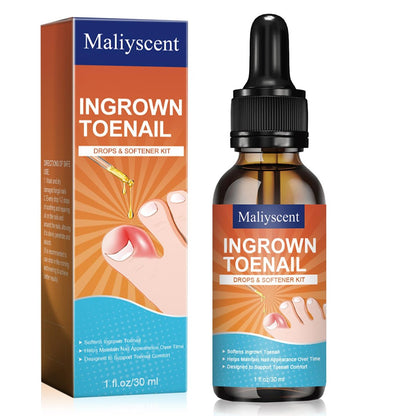 Maliyscent Tropfen gegen eingewachsene Zehennägel – Schmerzlinderung und Weichmacher für Männer und Frauen, Korrektur-Tropfen, 30 ml