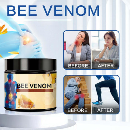 2er-Pack Bienen-Gift-Creme, MILEDY Bienen-Gift-Advanced-Creme, professionelles Bienen-Gift-Gel, feuchtigkeitsspendende Hautpflege
