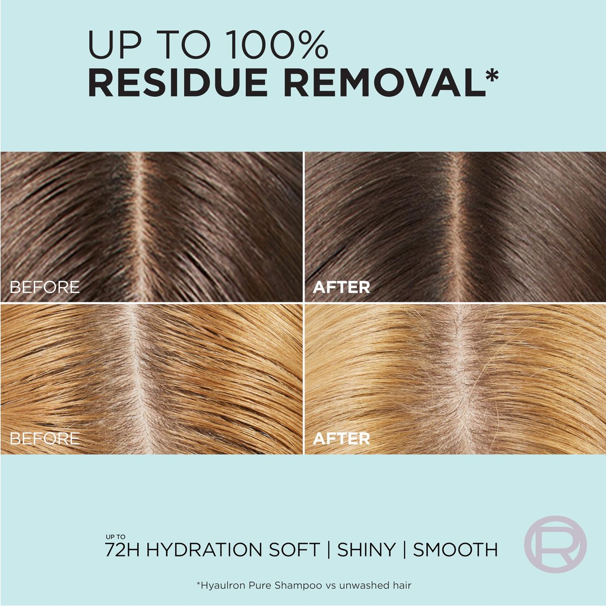 L'Oreal Paris Elvive Hyaluron + Pure 72H Feuchtigkeitsspendender Conditioner für fettiges Haar mit Salicylsäure und Hyaluronsäure, 828 ml