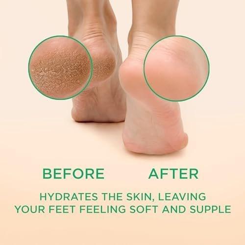 Lee Beauty Professional Gel Callus Remover für Füße - 8 oz - Pfefferminz Schnellwirkende Formel, Extra Stark für rissige Fersen & abgestorbene Haut (1er Pack)