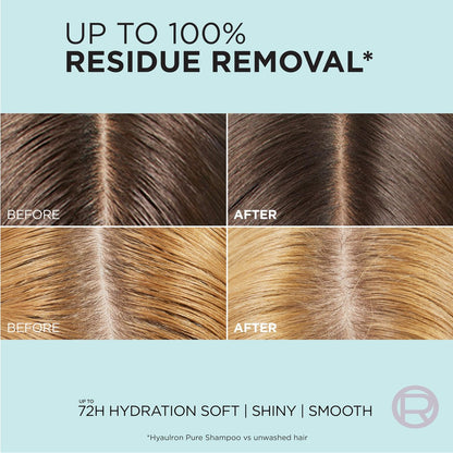 L'Oréal Paris Elvive Hyaluron + Pure Shampoo & Conditioner Set – Klärendes Shampoo und feuchtigkeitsspendender Conditioner mit Salicylsäure und Hyaluronsäure, 2 Flaschen à 400 ml