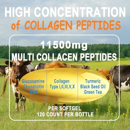 Kollagen-Peptide Weichkapseln, Multi-Kollagen-Peptid mit Glucosamin Chondroitin MSM Biotin, hydrolysiertes Kollagen-Peptid-Komplex für Frauen, unterstützt Haut, Haare, Nägel, Gelenke, Knochen, Darmgesundheit, Nicht-GMO, 120 Kapseln
