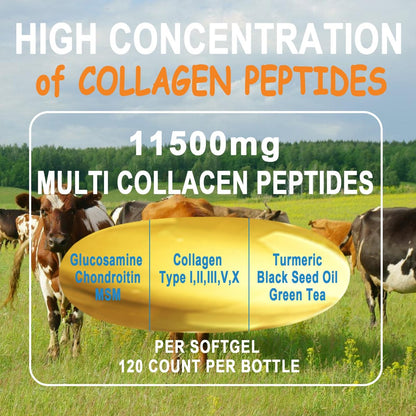 Kollagen-Peptide Weichkapseln, Multi-Kollagen-Peptid mit Glucosamin Chondroitin MSM Biotin, hydrolysiertes Kollagen-Peptid-Komplex für Frauen, unterstützt Haut, Haare, Nägel, Gelenke, Knochen, Darmgesundheit, Nicht-GMO, 120 Kapseln