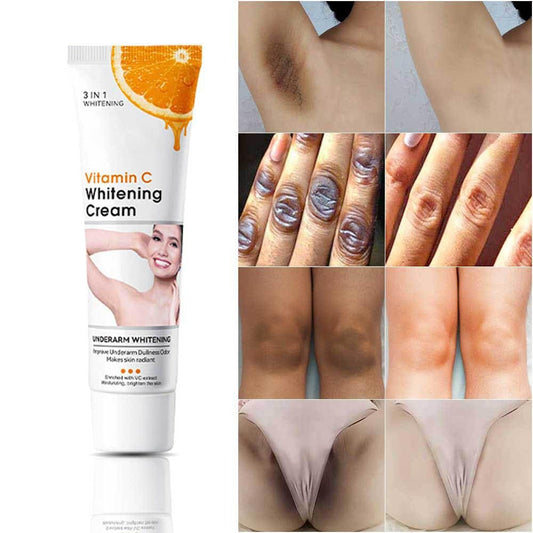 Axnoocy Körperaufhellungscreme für den Intimbereich und Bikinizone – Vitamin C Hautpflegecreme für Achseln, Hals, Ellbogen, Knie und Innenseiten der Oberschenkel (1,8 Fl. Oz.)