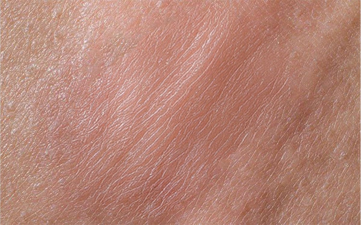 Terramed Just Think Comfort Genital Herpes Intimwaschmittel | Schnell wirkende HerpCare | Medizinisch | Lindert Juckreiz, Kribbeln & Brennen | Beruhigt Genitalherpes & Genitalbeschwerden