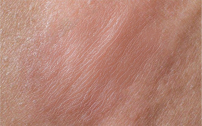 Terramed Just Think Comfort Genital Herpes Intimwaschmittel | Schnell wirkende HerpCare | Medizinisch | Lindert Juckreiz, Kribbeln & Brennen | Beruhigt Genitalherpes & Genitalbeschwerden
