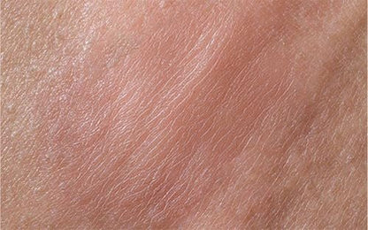 Terramed Just Think Comfort Genital Herpes Intimwaschmittel | Schnell wirkende HerpCare | Medizinisch | Lindert Juckreiz, Kribbeln & Brennen | Beruhigt Genitalherpes & Genitalbeschwerden