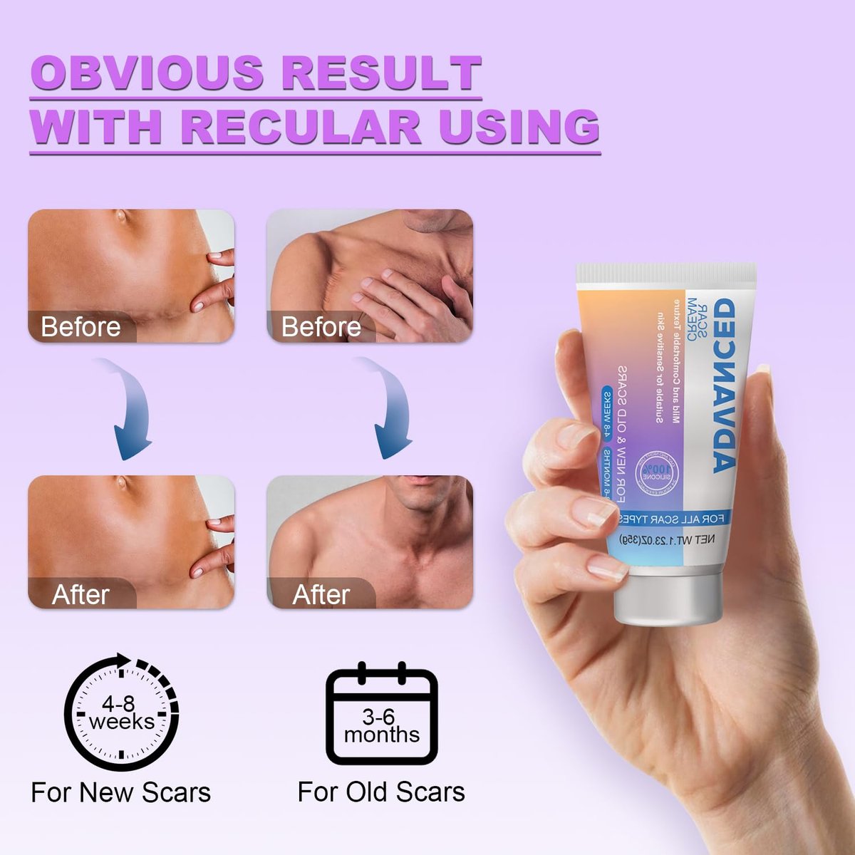 Silikon-Narbencreme Narbengel - Fortschrittliche Narbenbehandlung für Keloid-Bump-Entfernung bei chirurgischen Narben, Kaiserschnitt, Verletzungen, Dehnungsstreifen, Akne, Verbrennungen, Keloiden, alten & neuen Narben, 35 g