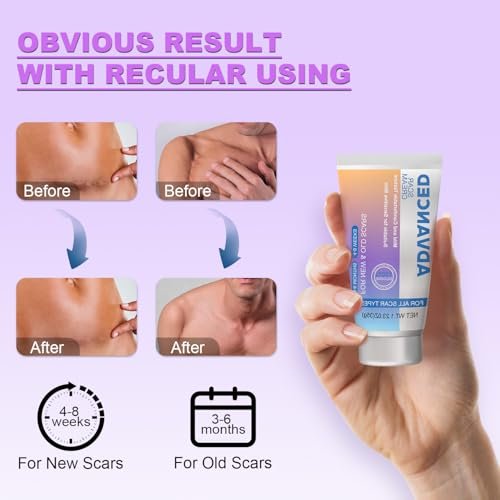 Silikon-Narbencreme Narbengel - Fortschrittliche Narbenbehandlung für Keloid-Bump-Entfernung bei chirurgischen Narben, Kaiserschnitt, Verletzungen, Dehnungsstreifen, Akne, Verbrennungen, Keloiden, alten & neuen Narben, 35 g