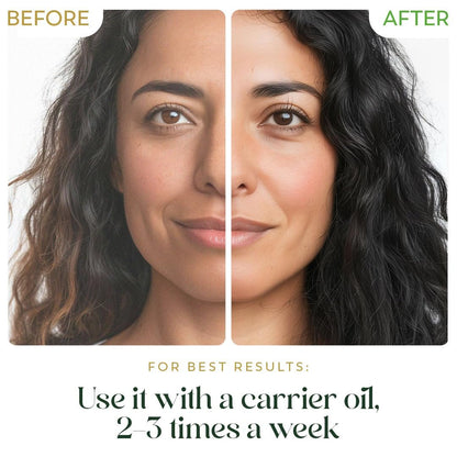 HerbsIndia Teebaumöl für die Haut - 100 ml - 100% rein, unverdünnt, Premium-Qualität mit Glaspipette, Non-GMO