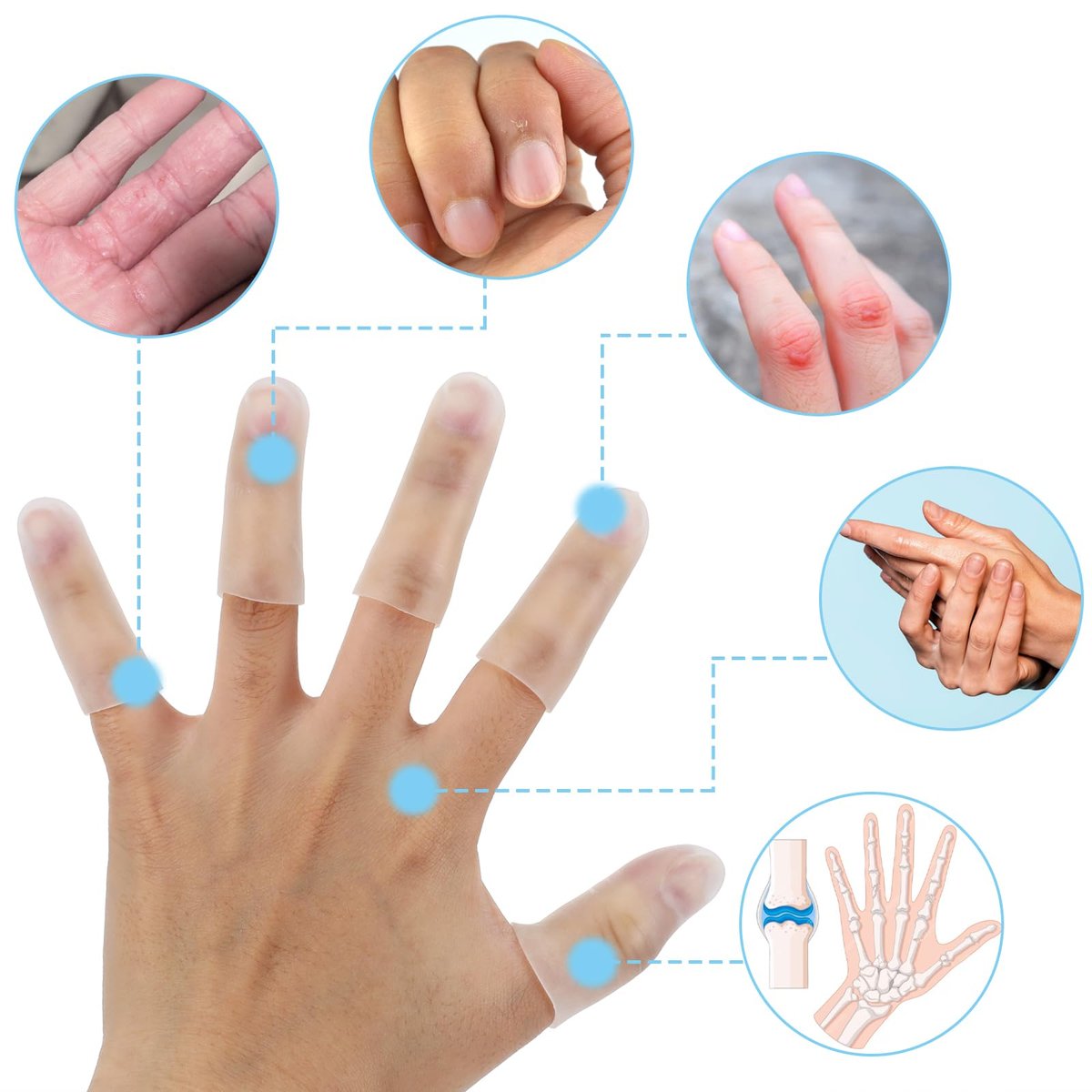 Gel-Fingerlinge, 10 Stück Gel-Fingerschutz, Fingerkappen aus Silikon, Fingerspitzen-Schutz, Fingerhülsen, Daumenschutz bei Handekzemen, rissigen Fingern und Arthritis (Transparent)