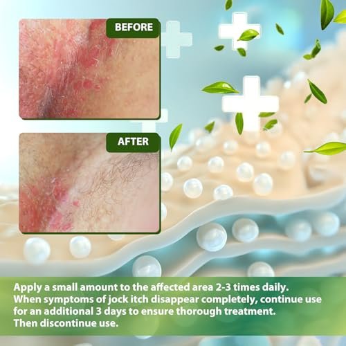 Recuren Plus Jock Itch Antifungal Creme: Teebaumöl Anti-Pilz Creme mit Aloe Vera, Lavendel & Eukalyptus – Extra starke Kräuter-Feuchtigkeitscreme zur Beruhigung juckender Haut – für Männer & Frauen, 30g