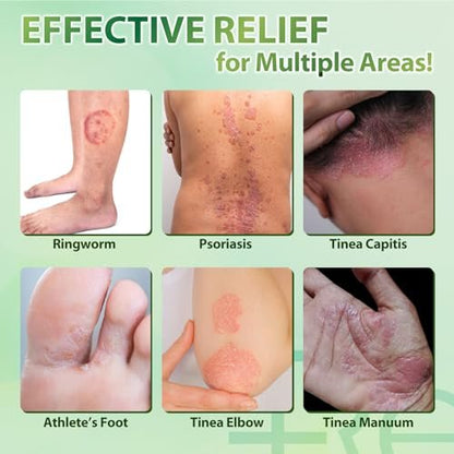 Recuren Plus Jock Itch Antifungal Creme: Teebaumöl Anti-Pilz Creme mit Aloe Vera, Lavendel & Eukalyptus – Extra starke Kräuter-Feuchtigkeitscreme zur Beruhigung juckender Haut – für Männer & Frauen, 30g