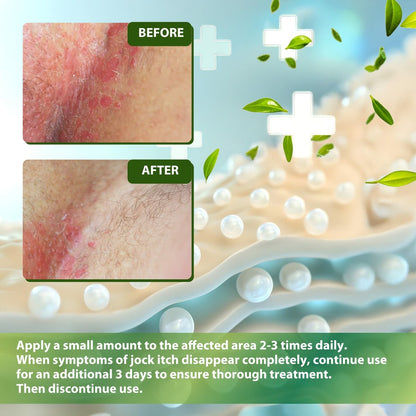 Recuren Plus Jock Itch Antifungal Creme: Teebaumöl Anti-Pilz Creme mit Aloe Vera, Lavendel & Eukalyptus – Extra starke Kräuter-Feuchtigkeitscreme zur Beruhigung juckender Haut – für Männer & Frauen, 30g