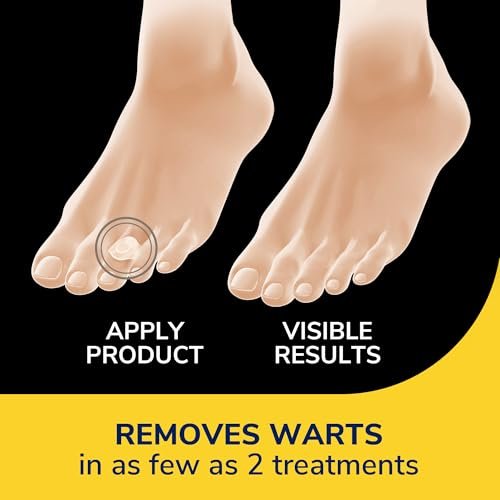Dr. Scholl's ONE-Step Warzenentferner, 14 Stück // Entfernt Warzen in nur 2 Anwendungen, maximale Stärke, einfache Ein-Schritt-Anwendung, haftet den ganzen Tag