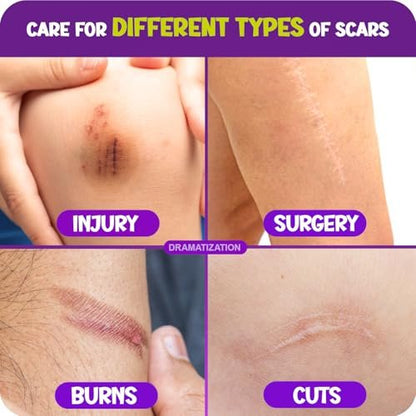 Cicatricure Advanced Scar Gel für Kinder – Sanfte Formel zur Verbesserung des Narbenbildes, glättet und pflegt die Haut, für Gesicht und Körper, Traubenduft, 28 g