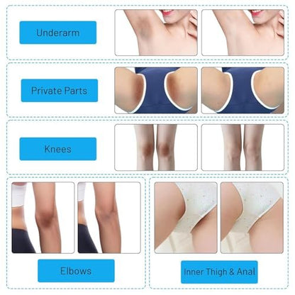 Hautaufhellungscreme für Intimbereich, Achseln, Knie, Ellbogen, Oberschenkel, Bikinizone – 60 ml