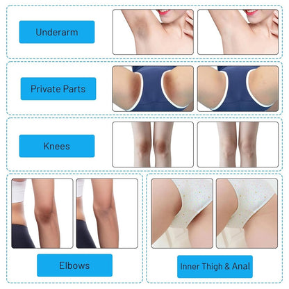 Hautaufhellungscreme für Intimbereich, Achseln, Knie, Ellbogen, Oberschenkel, Bikinizone – 60 ml