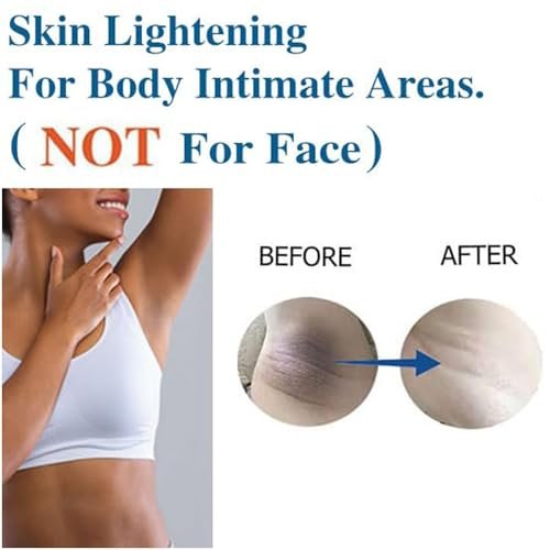 Hautaufhellungscreme für Intimbereich, Achseln, Knie, Ellbogen, Oberschenkel, Bikinizone – 60 ml