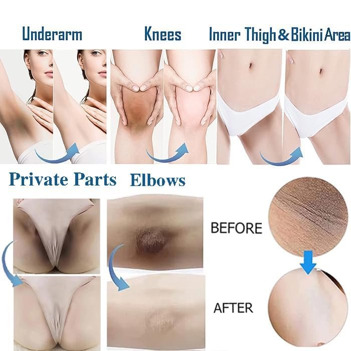 Hautaufhellungscreme für Intimbereich, Achseln, Knie, Ellbogen, Oberschenkel, Bikinizone – 60 ml