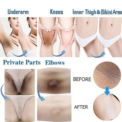Hautaufhellungscreme für Intimbereich, Achseln, Knie, Ellbogen, Oberschenkel, Bikinizone – 60 ml