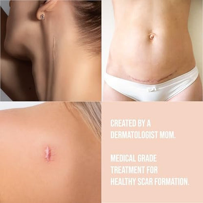 Quitch Silikon-Narbenpflaster für chirurgische Narben – Narbenband aus Silikon, C-Section Recovery Must Haves, Tummy Tuck Recovery, Postpartum Essentials Narbenbehandlung (Nude) 4x150cm